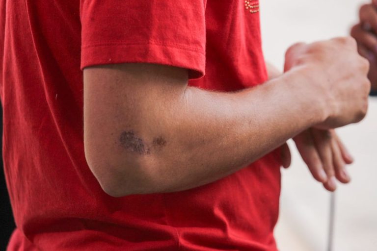 Defesa de atropelados quer que bêbado responda por homicídio tentado